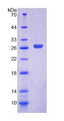 Rat GLNRS / QARS Protein (Recombinant His-T7, N-terminus)