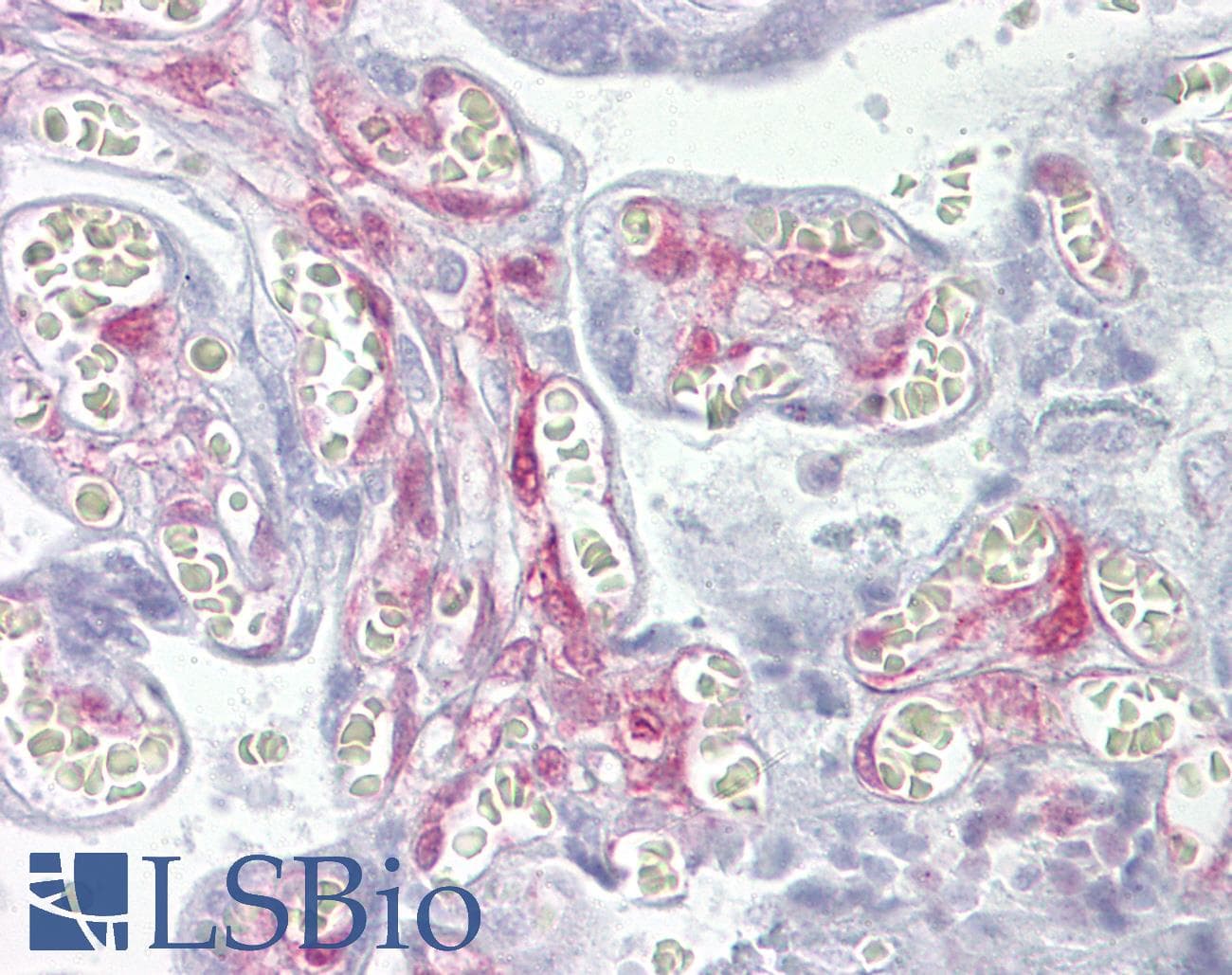 PathPlus™ LGALS1 / Galectin 1 Antibody (aa72-121)