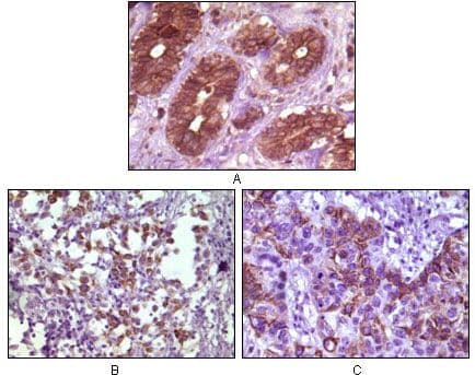 Monoclonal Mouse anti-Human BLK Antibody (clone 9D10B7, IHC, WB)