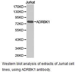 Polyclonal Rabbit anti-Human ADRBK1 / GRK2 Antibody (IHC, WB)