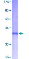 Human CDKN2B / p15 INK4b Protein (Recombinant GST)