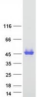 Human PTX3 / Pentraxin 3 Protein (Recombinant Myc-DDK (Flag))