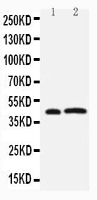 Polyclonal Rabbit anti-Human LPXN / Leupaxin Antibody (aa115-129, IHC, WB)