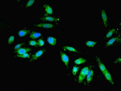 Polyclonal Rabbit anti-Human GBF1 Antibody (IHC, IF)