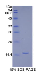 Mouse BGN / Biglycan Protein (Recombinant His)