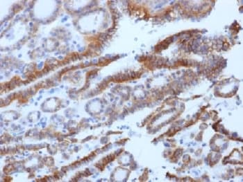 TSH Receptor / TSHR Antibody (clone SPM222, Azide-free, BSA-free)
