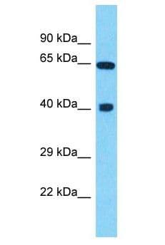 DYNC1LI2 Antibody (aa50-99)