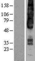 GPR4 Protein (Over-Expression Lysate Myc-DDK (Flag))