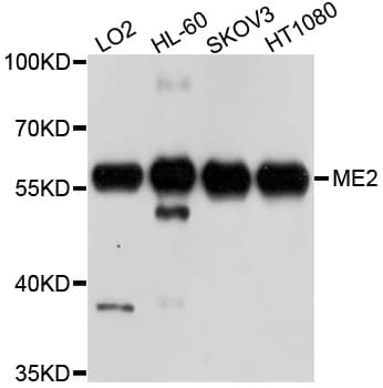 ME2 / Malate Dehydrogenase 2 Antibody