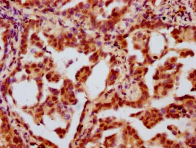 HIST1H2BN Antibody