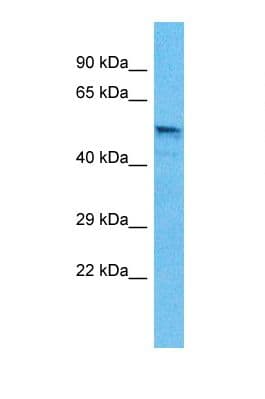 GABRB3 Antibody (aa191-240)