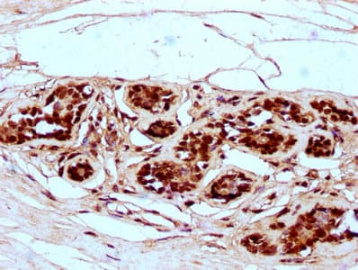 HIST1H2BN Antibody