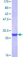 Human Corneodesmosin / CDSN Protein (Recombinant GST, N-terminus)