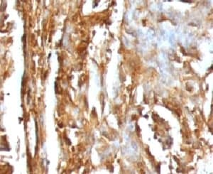 B2M / Beta 2 Microglobulin Antibody (clone MGBP2-1)