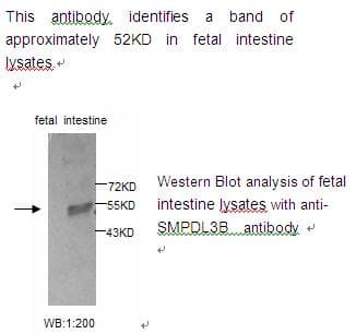 Polyclonal Rabbit anti-Human SMPDL3B Antibody (WB)