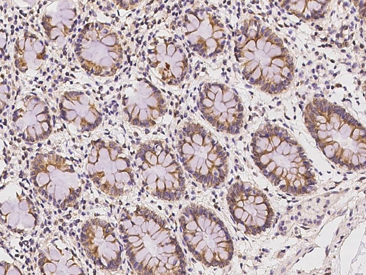 PANX1 / Pannexin 1 Antibody
