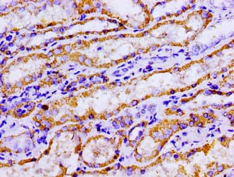 ACO2 / Aconitase 2 Antibody