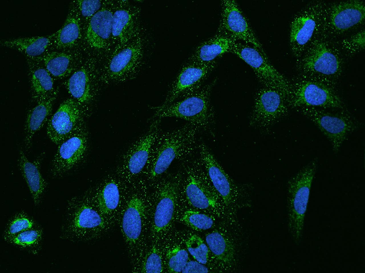 KCTD18 Antibody