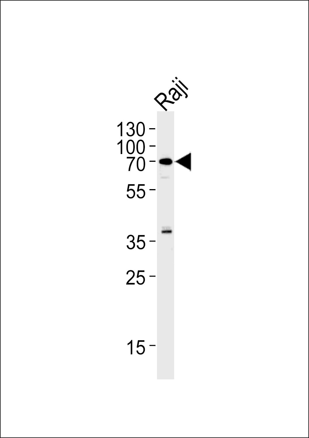 RICK / RIP2 Antibody (aa39-68)