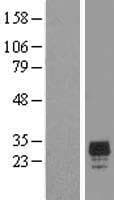 CHMP2A Protein (Over-Expression Lysate Myc-DDK (Flag))