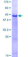 Human ETFA Protein (Recombinant GST)