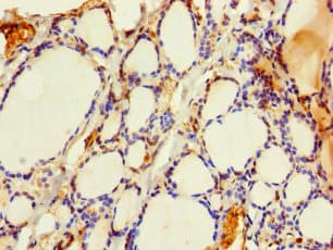 SLMO2 Antibody