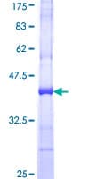 Human ESPL1 / Separase Protein (Recombinant GST, N-terminus)