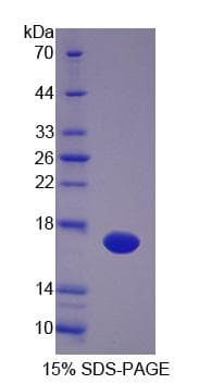 Chicken VEGFC Protein (Recombinant His-S)
