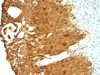 KRT19 / CK19 / Cytokeratin 19 Antibody (clone KRT19/799 + KRT19/800, Azide-free, BSA-free)
