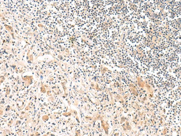 TOCA1 / FNBP1L Antibody
