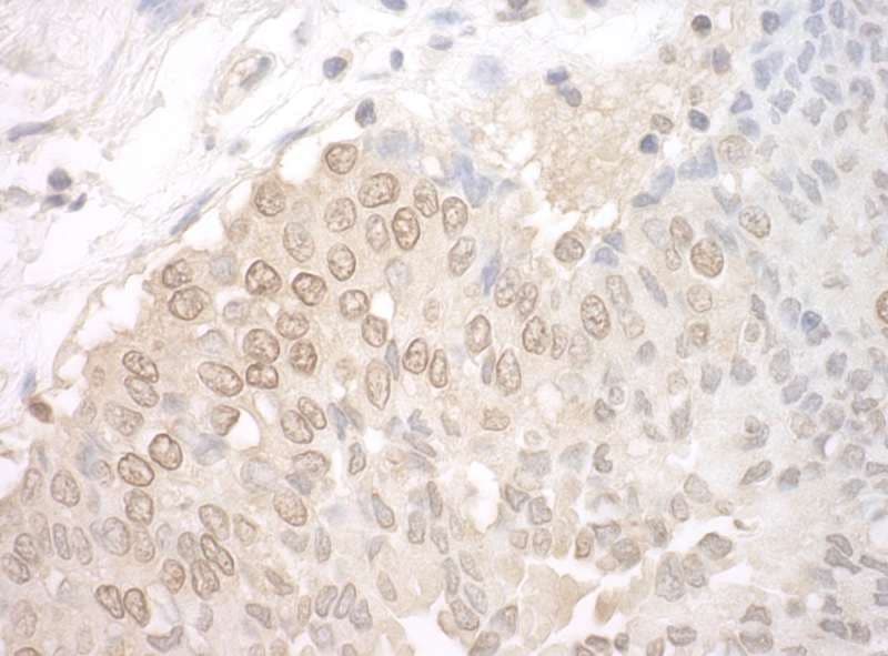 UCKL1 Antibody (aa50-100)