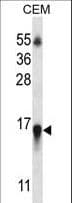 HIST1H2BN Antibody (aa1-30)
