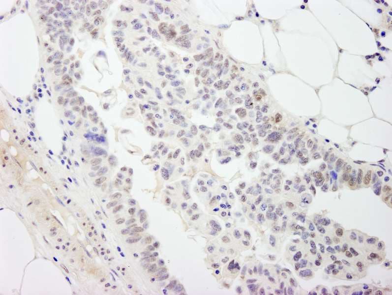 DP97 / DDX54 Antibody (aa625-675)