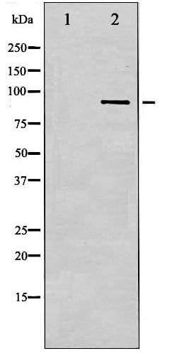 IKBKB / IKK2 / IKK Beta Antibody (phospho-Tyr188)