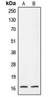 CRABP2 Antibody (Internal)