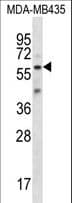 FSCN3 Antibody (aa296-324)