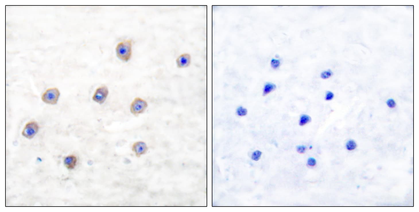 TH / Tyrosine Hydroxylase Antibody (phospho-Ser31)