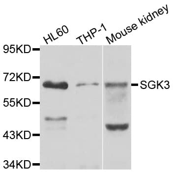 Polyclonal Rabbit anti-Human SGK3 Antibody (WB)