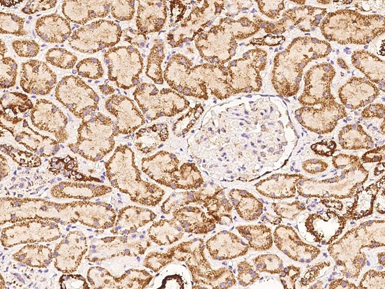 Polyclonal Rabbit anti-Human COQ2 Antibody (IHC)