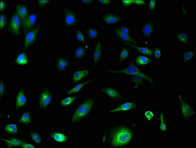 Polyclonal Rabbit anti-Human S100A10 Antibody