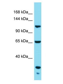 KIAA1522 Antibody (aa1028-1077)