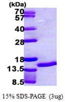 Human S100A7 / Psoriasin Protein (Recombinant His, N-Terminal)