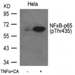 Polyclonal Rabbit anti-Human RELA / NFKB p65 Antibody (IHC, IF, WB)