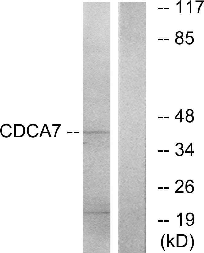 Polyclonal Rabbit anti-Human CDCA7 Antibody (WB)