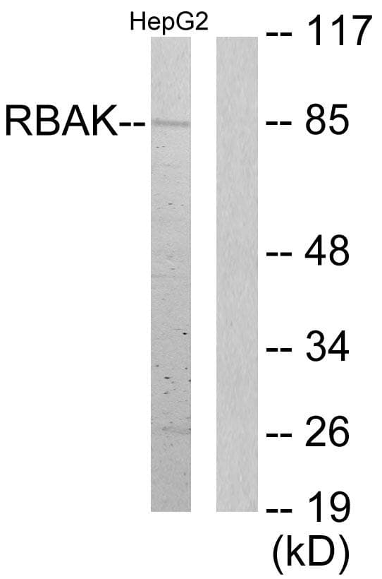Polyclonal Rabbit anti-Human RBAK Antibody (WB)