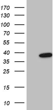 FBXO6 Antibody (clone OTI1H8)