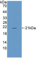 MB / Myoglobin Antibody (aa1-154)