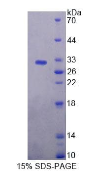 Human BAG5 Protein (Recombinant His-T7, N-terminus)