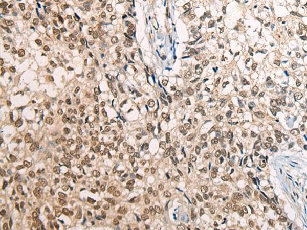 CDT1 Antibody