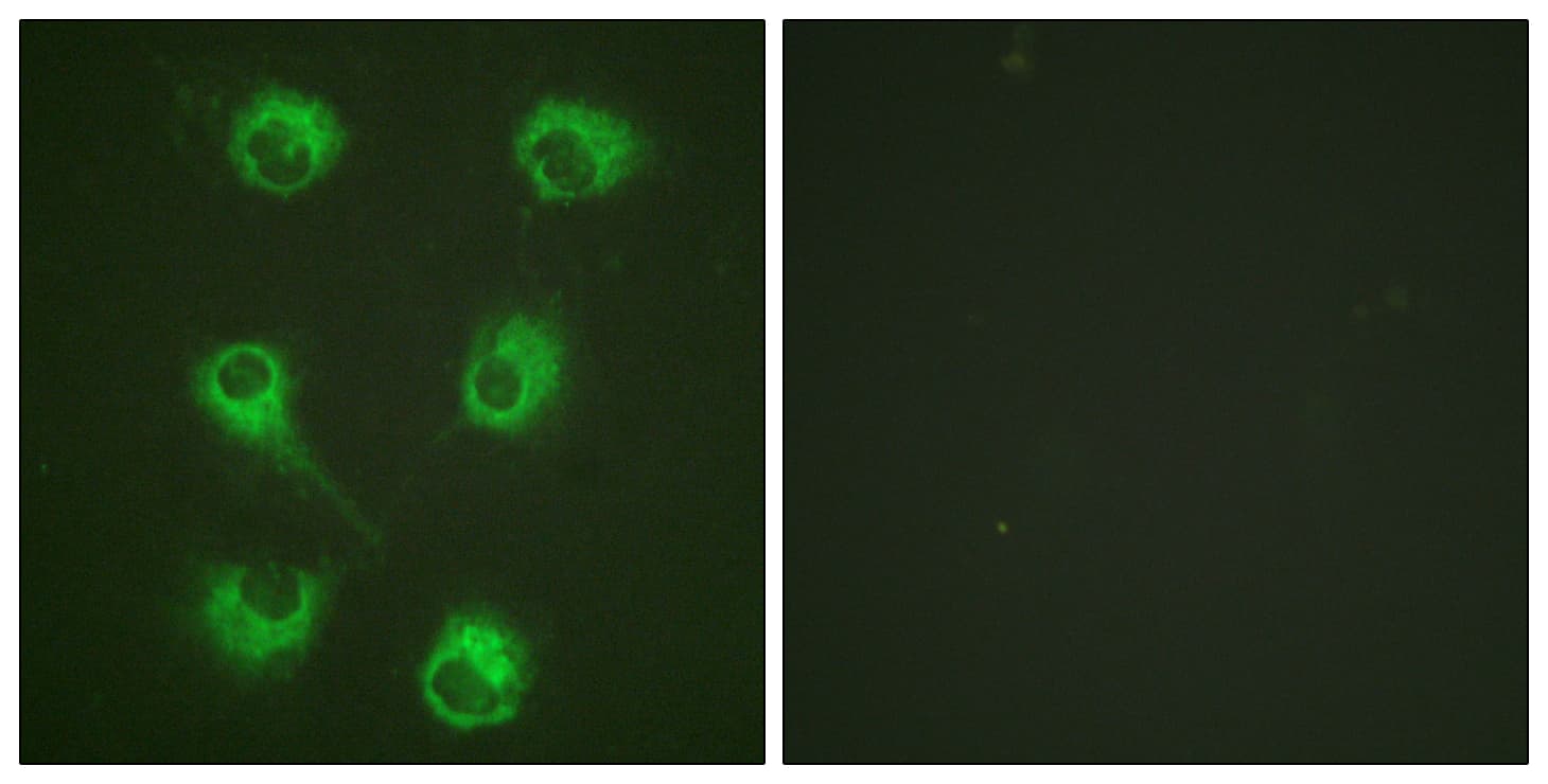 Polyclonal Rabbit anti-Human CRKL Antibody (aa173-222, IHC, IF, WB)